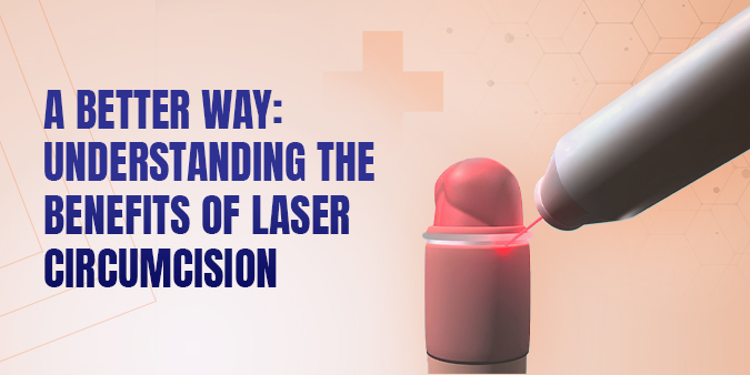 A Better Way: Understanding the Benefits of Laser Circumcision